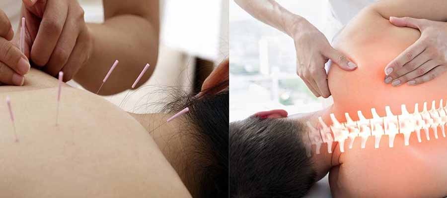 Acupuncture vs. Chiropractic: Which Treatment is Right for You?